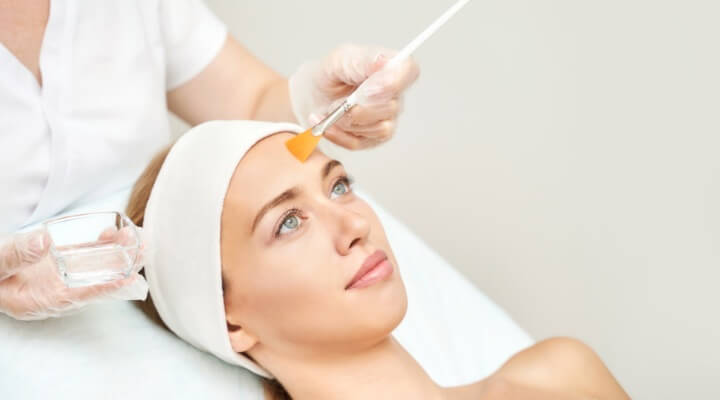 woman getting chemical peel