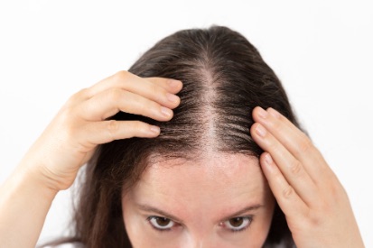 woman inspecting hair loss in middle part