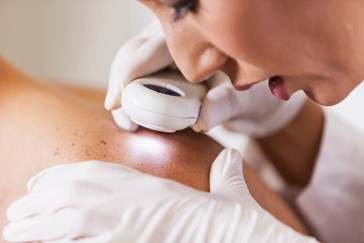 In-Depth Look at Skin Cancer Rates